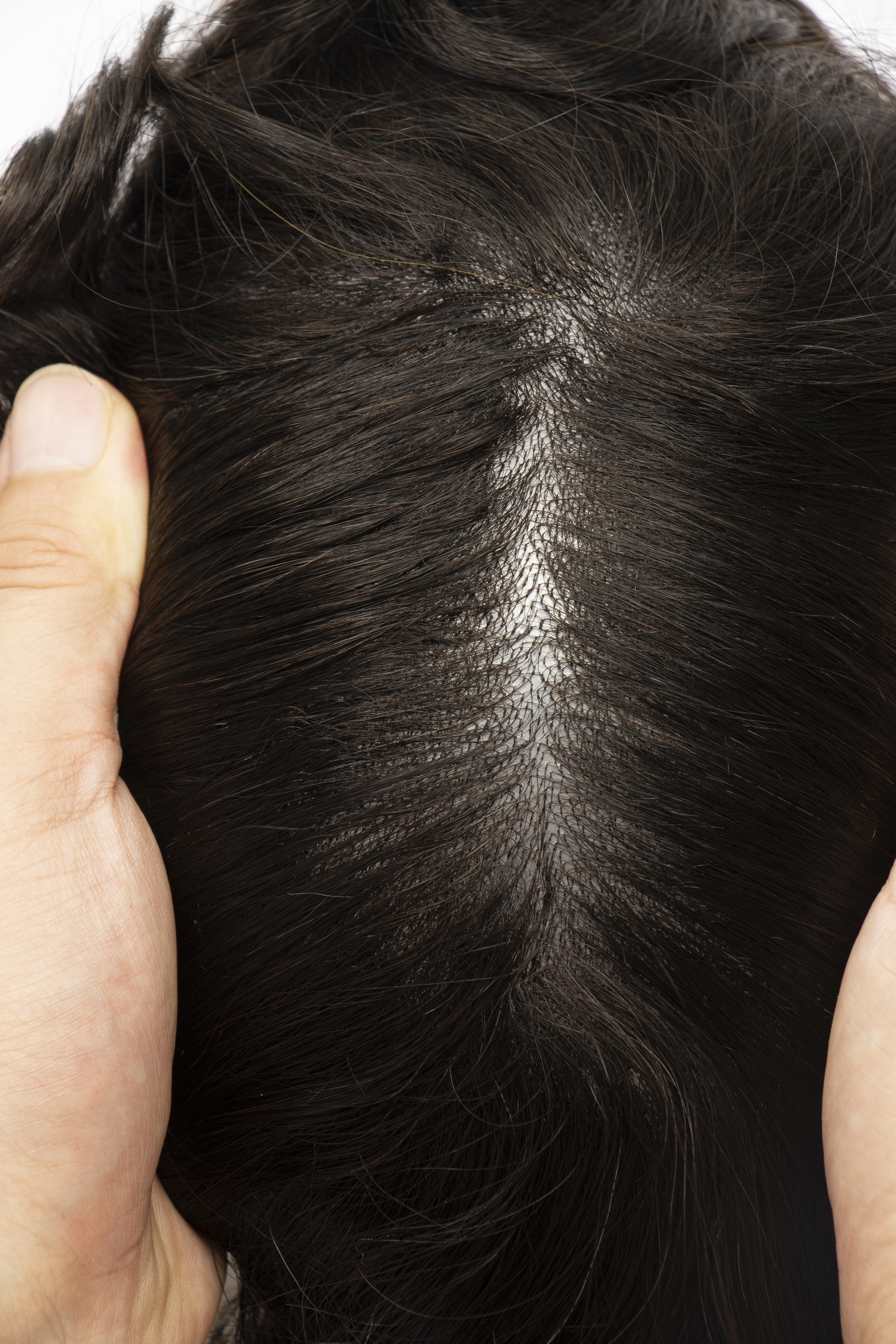 Wie w&auml;hlt man die passende Haardichte f&uuml;r ein Haarsystem?