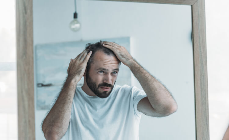 Tinea‑Capitis‑bedingter Haarausfall: Symptome, Ursachen und Behandlung