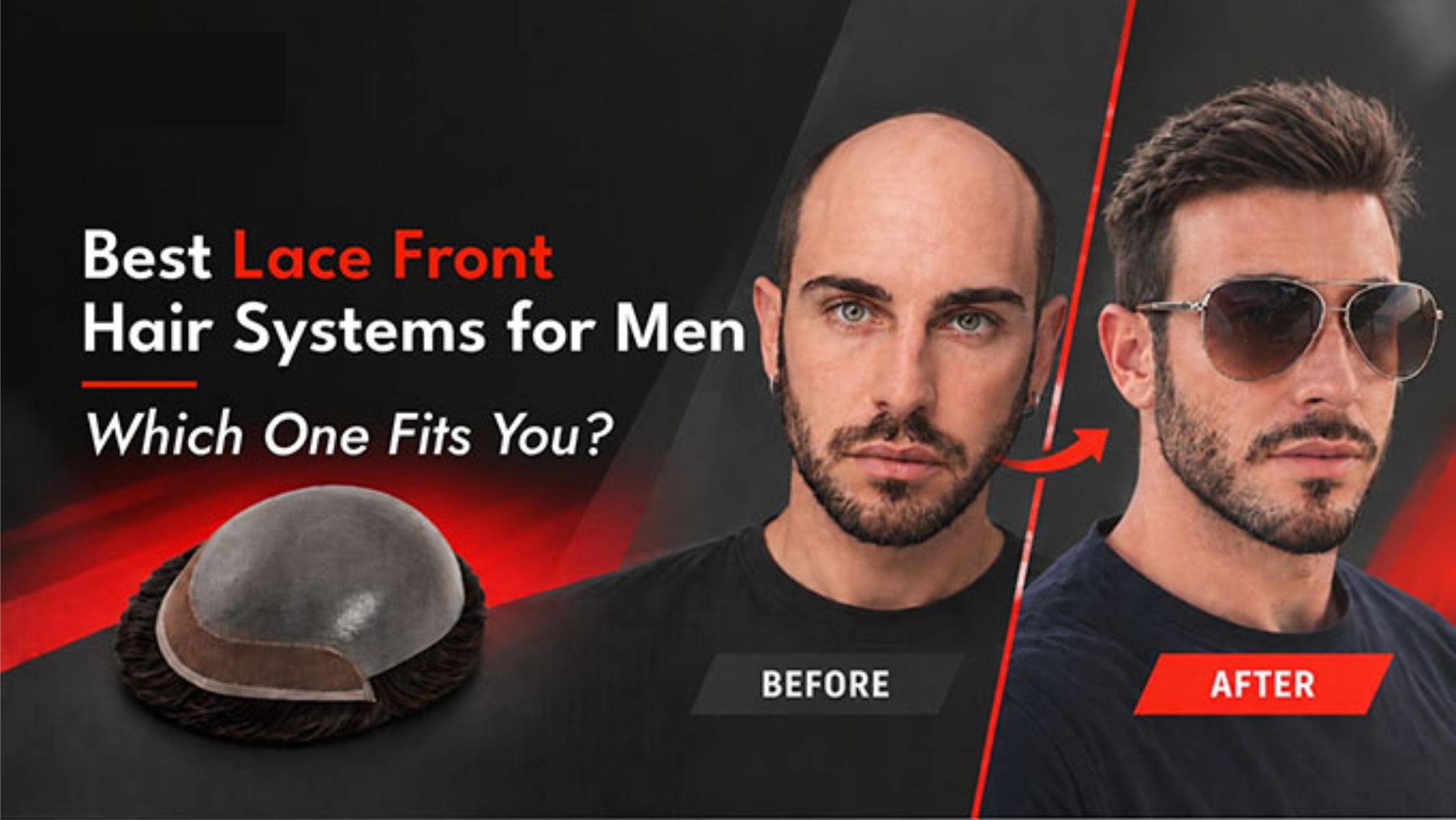 Die besten Lace-Front-Haarsysteme f&uuml;r M&auml;nner: Welches passt zu Ihnen?